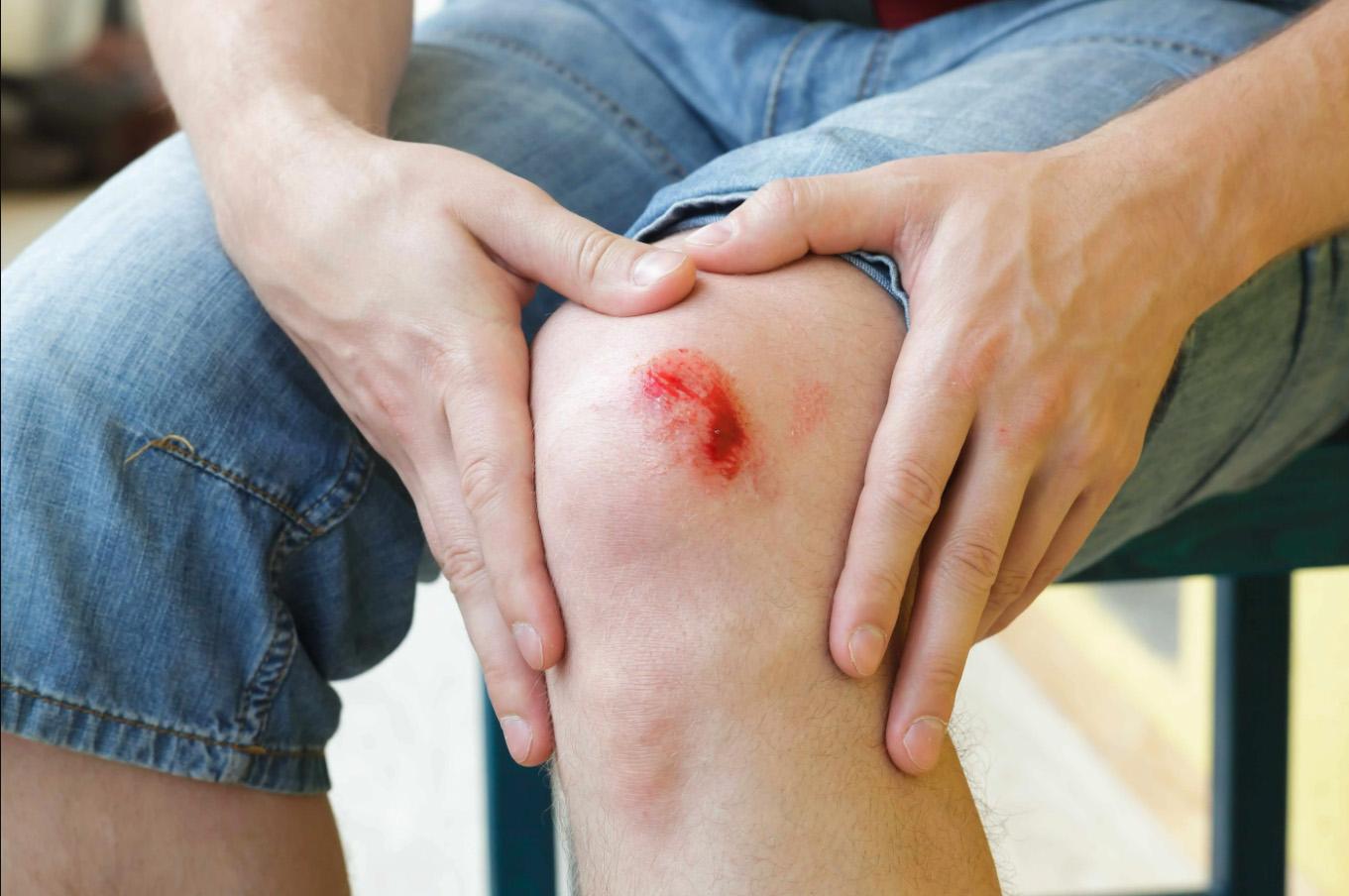 First Aid Essentials: How to Treat Scrapes, Cuts, and Minor Burns