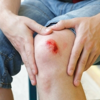 First Aid Essentials: How to Treat Scrapes, Cuts, and Minor Burns